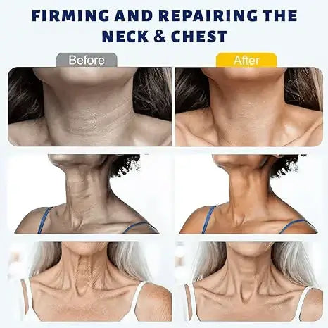 ✨Instant Neck Lift Cream — ✨ Infused with Retinol & Hyaluronic Acid | Firms the Neck, Reduces Wrinkles & Double Chin