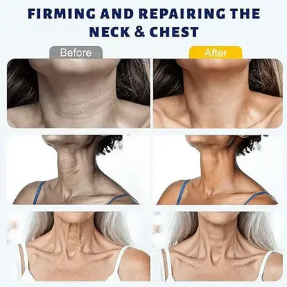 ✨Instant Neck Lift Cream — ✨ Infused with Retinol & Hyaluronic Acid | Firms the Neck, Reduces Wrinkles & Double Chin